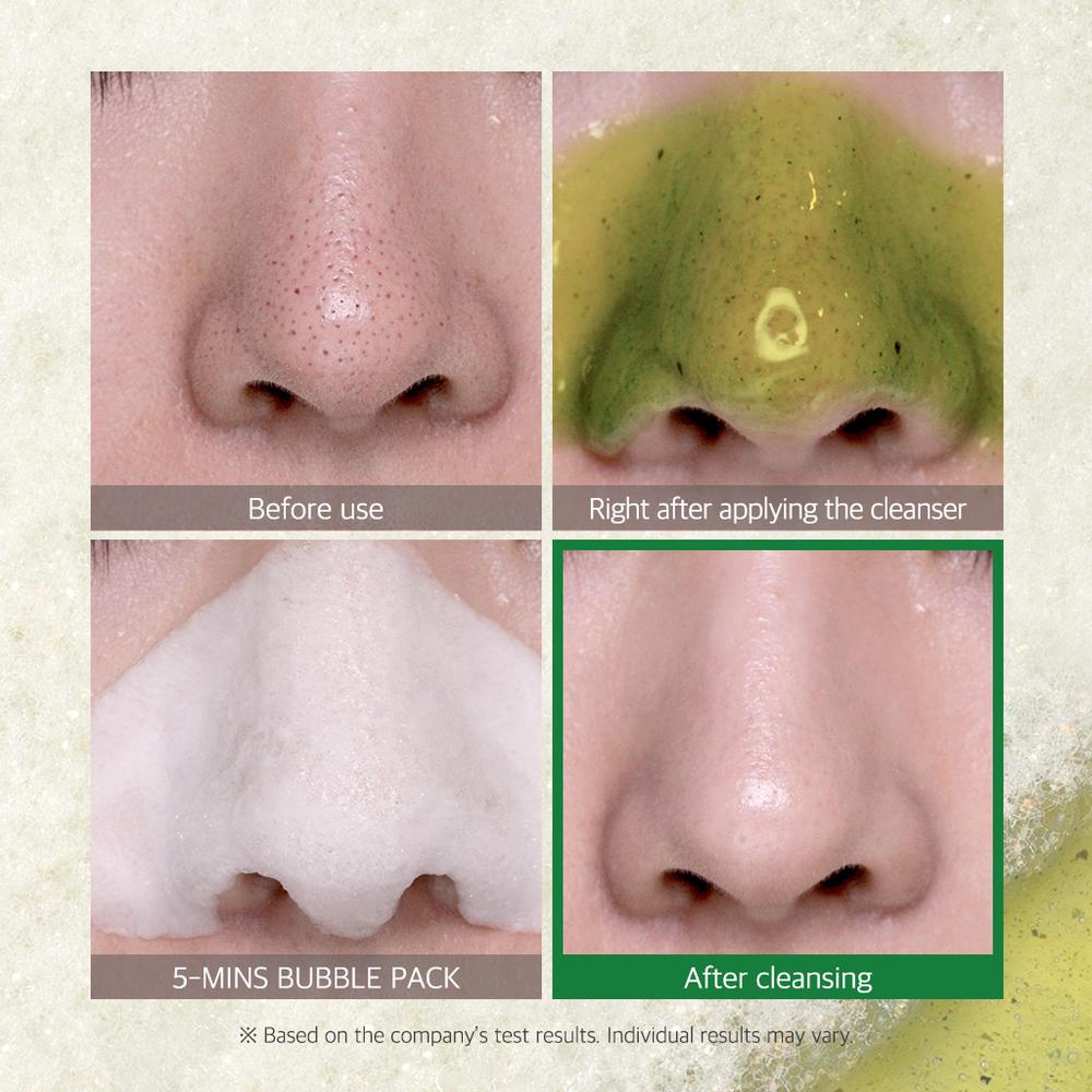 Bye Bye Blackhead 30 Days Miracle Green Tea Tox Bubble Cleanser - BASIC MADE CO